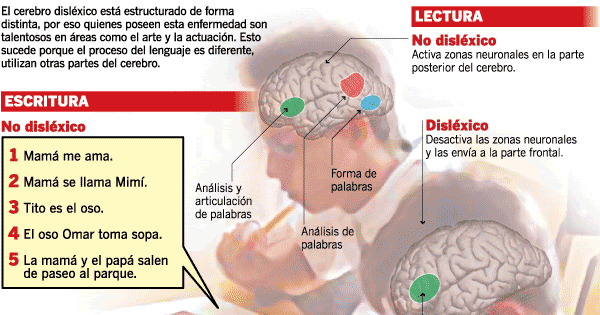 DSM Trastorno espec fico del aprendizaje